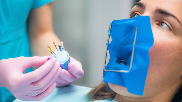 What to Expect From a Root Canal Procedure: Step by Step