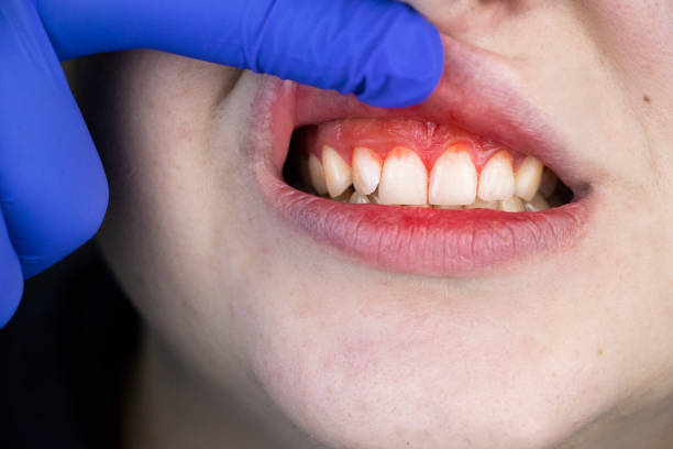 how to keep gums healthy