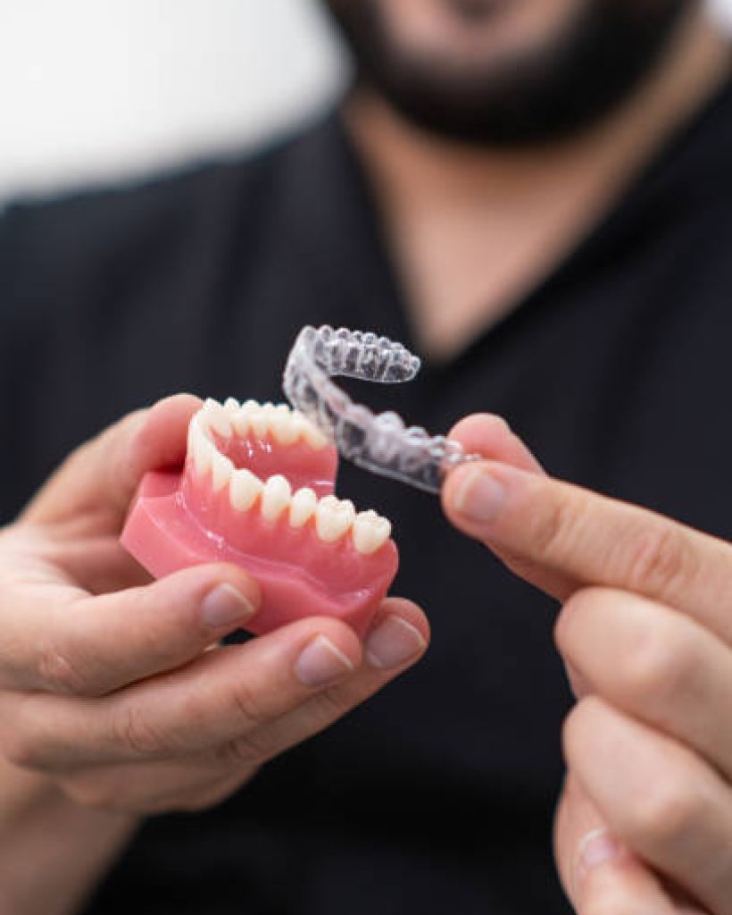 braces and aligners